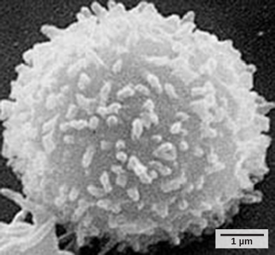 La micrografía muestra una célula que parece una bola de nieve borrosa.