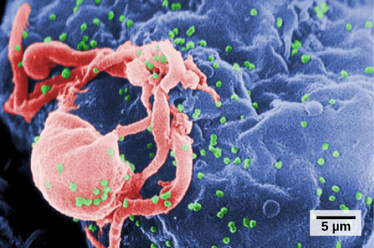 Una micrografía electrónica de barrido coloreado de un linfocito con extensiones citoplásmicas, y muchas pequeñas esferas que salen del linfocito y se dispersan a su alrededor.