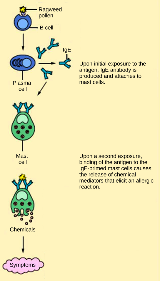 La ilustración muestra polen de ragweed adherido a la superficie de una célula B. El linfocito B se activa, produciendo células plasmáticas que liberan IgE. La IgE se presenta en la superficie de un mastocito. Tras una segunda exposición, la unión del antígeno a los mastocitos cebados con IgE provoca la liberación de mediadores químicos que provocan una reacción alérgica.