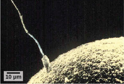 Micrograph shows a sperm whose head is touching the surface of an egg. The egg is much larger than the sperm.