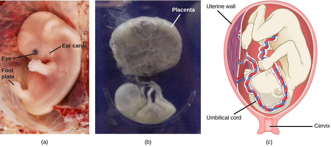 Part a: Photo shows a human fetus, with a large bent head and a dark eye, fingers on its arm and a leg bud. The spine is visible through the back, and the abdomen protrudes out as far as the leg bud. Part b: The second trimester fetus has long arms and legs, and is attached to the placenta, which is round and larger than the fetus. Part c: This illustration shows a third trimester fetus, which is a fully developed baby. The fetus is upside down and pressing on the cervix. The thick umbilical cord extends from the fetus’ belly to the placenta.
