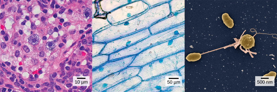 Part a: Human cheek cells as viewed by light microscopy have an irregular round shape and a well-defined nucleus that takes up about one-half of the cell. Part b: Onion skin cells, also viewed by light microscopy, are long and thin with a rectangular shape defined by a cell wall. They are about as wide as a cheek cell, but at least five times as long. The cell wall and nucleus are well defined in the micrograph. The onion cell nucleus is about the same size as the cheek cell nucleus. Part c: In this scanning electron micrograph of bacterial cells, the cell surface has a three-dimensional shape. Three of the bacteria are oval in shape. The fourth is round and has protrusions called pili. One pilus connects this bacterium to another.