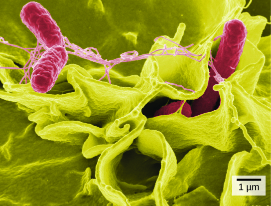 Parte a: A salmonela através de um microscópio de luz aparece como pequenos pontos roxos. Parte b: Nesta micrografia eletrônica de varredura, as bactérias aparecem como ovais tridimensionais. As células humanas são muito maiores com uma aparência complexa e dobrada. Algumas das bactérias estão na superfície das células humanas e outras são comprimidas entre elas.