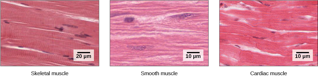 Las células del músculo esquelético son largas y aparecen estriadas debido a la disposición de sus miofilamentos. Cada célula tiene múltiples núcleos. Las células del músculo liso no tienen estrías y solo un núcleo por célula. Las células del músculo cardíaco están estriadas pero tienen un solo núcleo. Las celdas están dispuestas en haces ramificados.